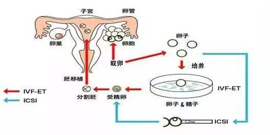 长春试管婴儿